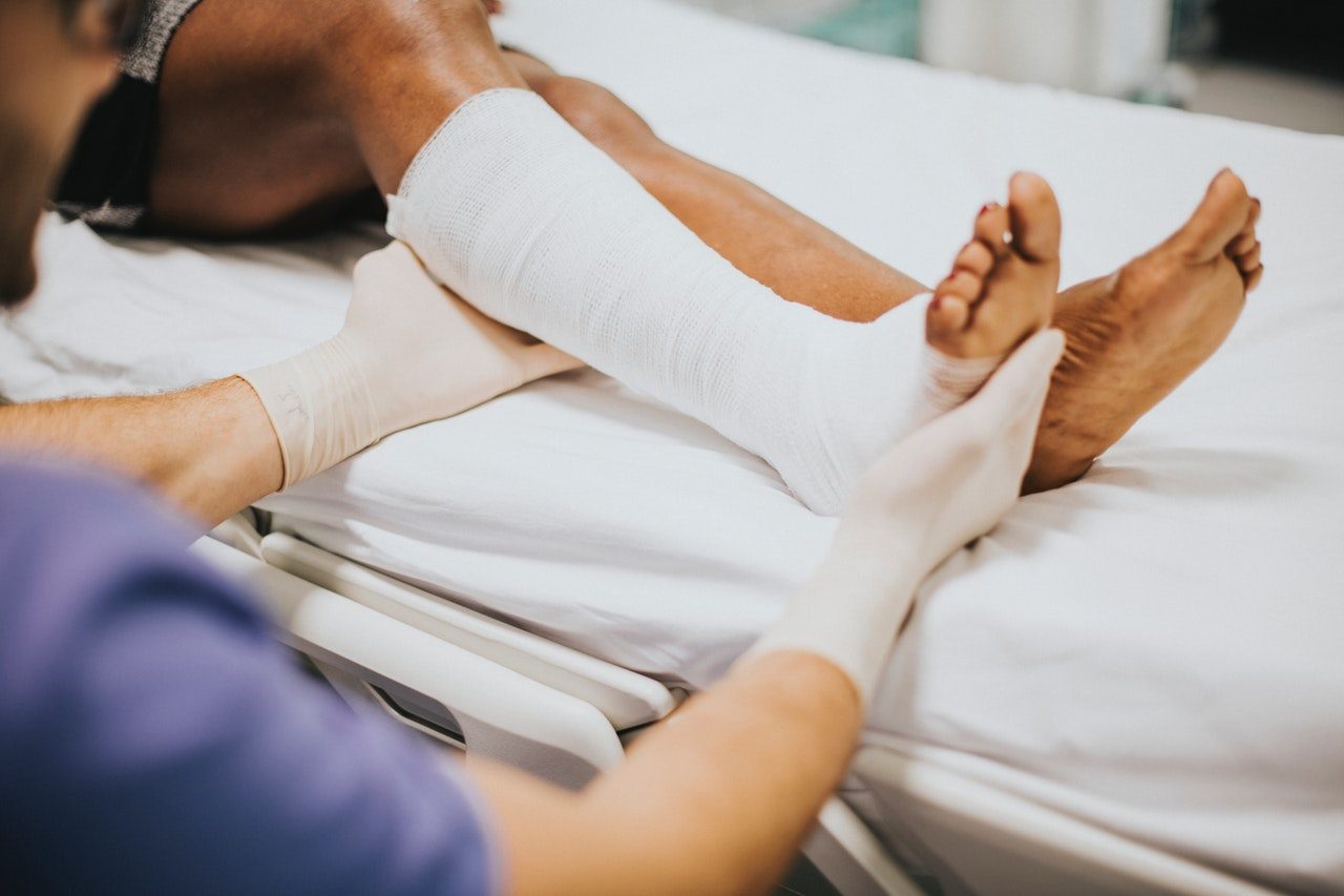 A patient in hospital with a bandaged leg